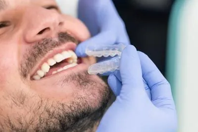 patient getting fitted for his new Invisalign clear aligners